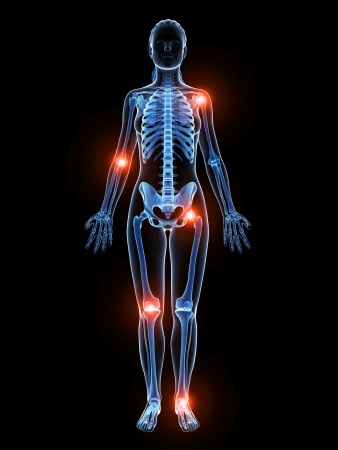 Can arthritis cause vehicle accidents - Spivey Law Firm, Personal Injury Attorneys, P.A.