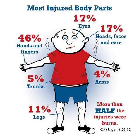 Fireworks Injuries - Most Injured Body Parts