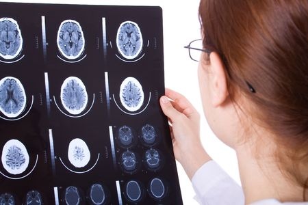 Review of Bicyclist Brain Injuries During Brain Injury Awareness Month