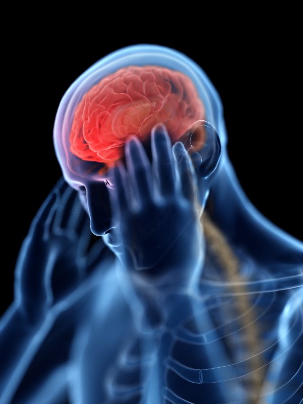 Concussion Symptoms Vary from Person to Person