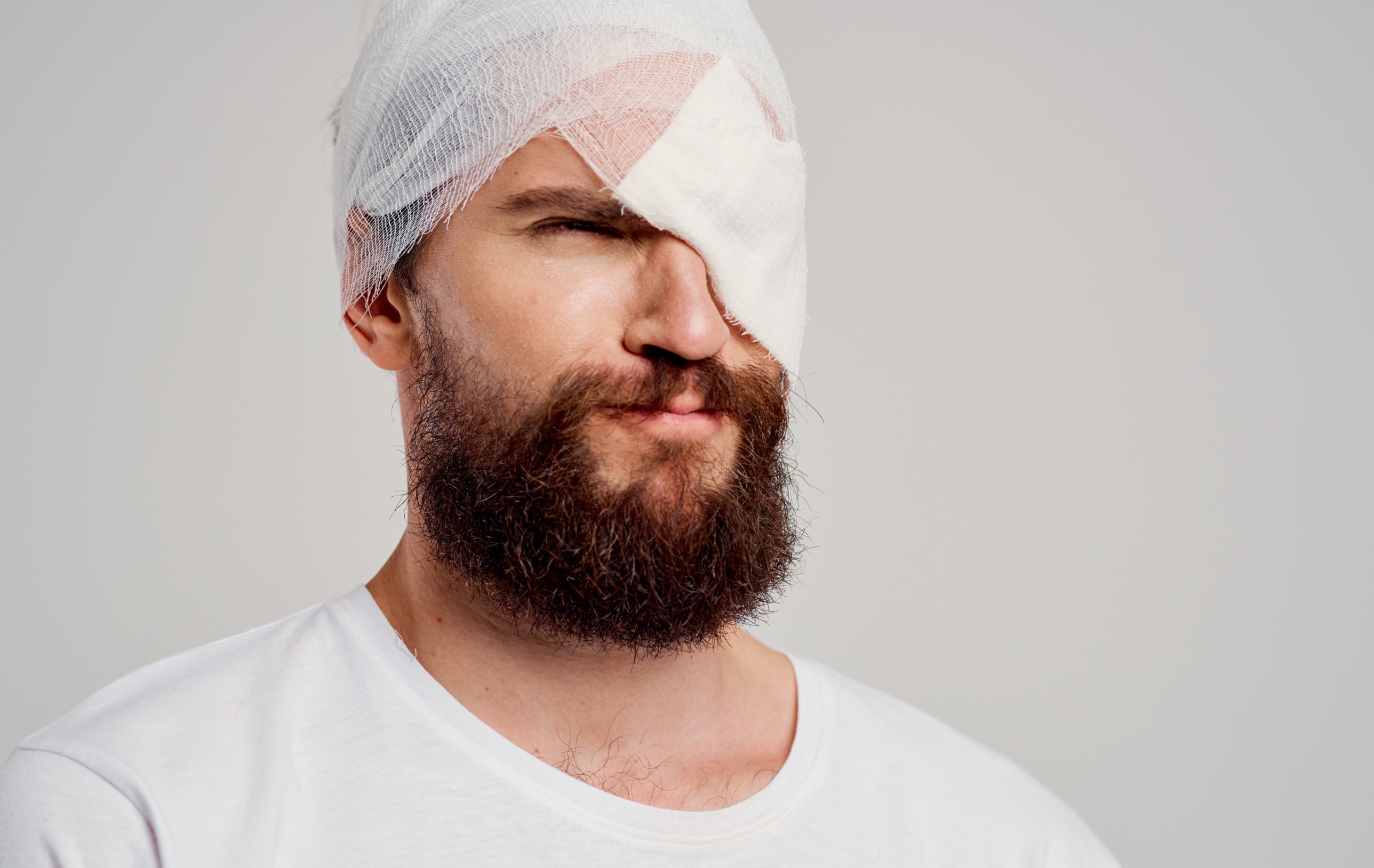 What are the most common types of eye injures in a vehicle accident